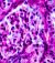Pathology histo 2x
